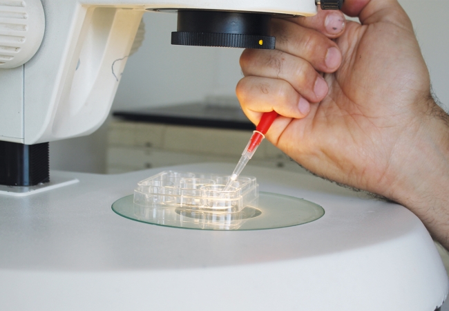 Transplantation embryonnaire